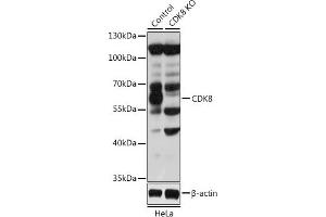 CDK8 antibody  (AA 365-464)