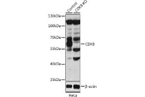 Western blot analysis of extracts from normal (control) and CDK8 knockout (KO) HeLa cells, using CDK8 antibody (ABIN6129240, ABIN6138329, ABIN6138330 and ABIN7101776) at 1:1000 dilution.