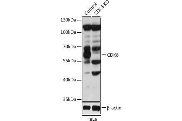 CDK8 anticorps  (AA 365-464)