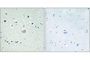 Immunohistochemistry analysis of paraffin-embedded human brain tissue, using BAI3 Antibody. (BAI3 antibody  (AA 211-260))