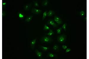 Immunofluorescence staining of A549 cells with ABIN7127704 at 1:100,counter-stained with DAPI. (Recombinant C-JUN antibody  (pSer63))