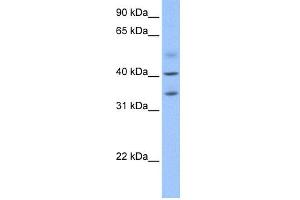 WB Suggested Anti-ZC3H14 Antibody Titration: 0.