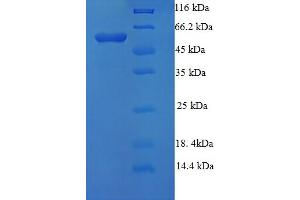 SDS-PAGE (SDS) image for Nuclear Receptor Subfamily 1, Group H, Member 3 (NR1H3) (AA 1-402), (Isoform 3) protein (His-SUMO Tag) (ABIN5711283) (NR1H3 Protein (AA 1-402, Isoform 3) (His-SUMO Tag))