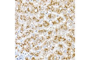 Immunohistochemistry (IHC) image for anti-Cathepsin D (CTSD) (AA 65-412) antibody (ABIN6139223)