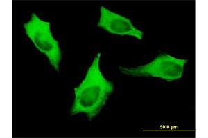 Immunofluorescence of monoclonal antibody to MYH9 on HeLa cell. (Myosin 9 antibody  (AA 131-220))