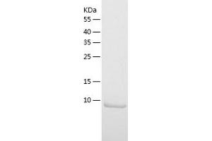 Western Blotting (WB) image for S100 Calcium Binding Protein A10 (S100A10) (AA 1-97) protein (His tag) (ABIN7285131) (S100A10 Protein (AA 1-97) (His tag))