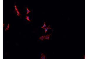 ABIN6266808 staining HeLa cells by IF/ICC.