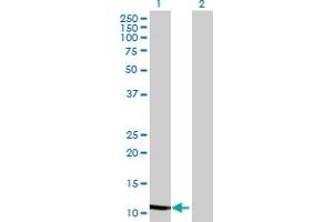 Western Blot analysis of WFDC5 expression in transfected 293T cell line by WFDC5 MaxPab polyclonal antibody. (WFDC5 antibody  (AA 1-123))