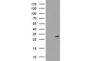 Image no. 1 for anti-Myeloid Leukemia Factor 1 (MLF1) antibody (ABIN1499497) (MLF1 antibody)