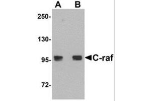 Western Blotting (WB) image for anti-V-Raf-1 Murine Leukemia Viral Oncogene Homolog 1 (RAF1) (N-Term) antibody (ABIN781705) (RAF1 antibody  (N-Term))