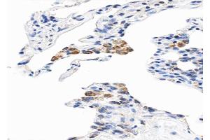 ABIN6268821 at 1/100 staining human Lung tissue sections by IHC-P.