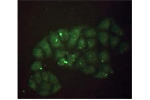 Stainning of methanol-fixed Hela cells: Mouse anti-Human beta 2 Microglobulin monoclonal antibody (D2A10) 1/50 (20 µg/ml). (beta-2 Microglobulin antibody)