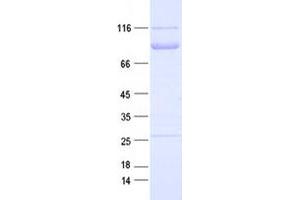 Western Blotting (WB) image for Karyopherin (Importin) beta 1 (KPNB1) protein (DYKDDDDK Tag) (ABIN2727677)