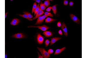 MCF-7 cells were stained with WDR26 Polyclonal Antibody, Unconjugated at 1:500 in PBS and incubated for two hours at 37°C followed by Goat Anti-Rabbit IgG (H+L) Cy3 conjugated secondary antibody. (WDR26 antibody  (AA 101-200))