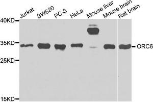 Western blot analysis of extracts of various cells, using ORC6 antibody. (ORC6 antibody)