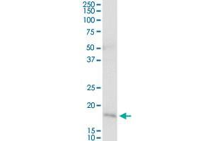 NNT MaxPab rabbit polyclonal antibody. (NNT antibody  (AA 1-207))