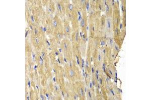 Immunohistochemistry (Paraffin-embedded Sections) (IHC (p)) image for anti-Phospholipase C gamma 2 (PLCG2) (AA 1-300) antibody (ABIN3023145)