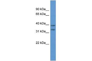 WB Suggested Anti-BRMS1L Antibody Titration: 1.