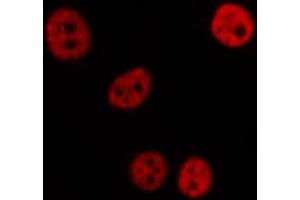 ABIN6276993 staining  Hela cells by IF/ICC. (RPL5 antibody  (Internal Region))