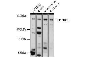 Western blot analysis of extracts of various cell lines, using PPP1R9B antibody (ABIN7269680) at 1:1000 dilution. (PPP1R9B antibody)