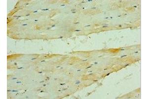 Immunohistochemistry of paraffin-embedded human skeletal muscle tissue using ABIN7142006 at dilution of 1:100 (PDK2 antibody  (AA 128-407))
