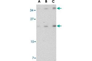 Western blot analysis of DARC in mouse brain tissue lysate with DARC polyclonal antibody  at (A) 0.