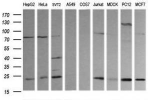 Image no. 3 for anti-RAB30, Member RAS Oncogene Family (RAB30) antibody (ABIN1500559) (RAB30 antibody)