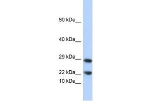 Lipocalin 8 antibody used at 1 ug/ml to detect target protein. (LCN8 antibody  (N-Term))