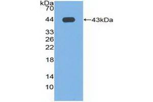 Figure. (Phospholipase D antibody  (AA 725-1074))
