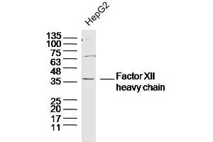 Human HepG2 cells probed with Factor XII heavy chain Polyclonal Antibody, unconjugated  at 1:300 overnight at 4°C followed by a conjugated secondary antibody at 1:10000 for 90 minutes at 37°C. (Factor 12 Heavy Chain (F12) antibody)