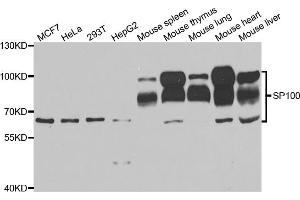 Western blot analysis of extracts of various cell lines, using SP100 antibody. (SP100 antibody)