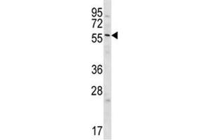GPC3 antibody western blot analysis in Jurkat lysate (Glypican 3 antibody  (AA 529-560))