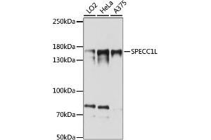 SPECC1L 抗体  (AA 200-500)