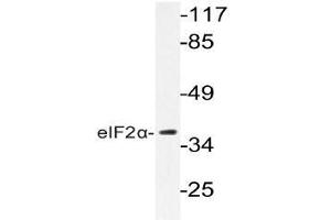 Western blot (WB) analyzes of eIF2alpha antibody in extracts from K562 cells. (EIF2S1 antibody)