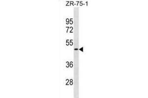 Western Blotting (WB) image for anti-Olfactory Receptor, Family 1, Subfamily S, Member 2 (OR1S2) antibody (ABIN3001078)