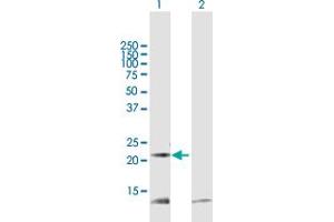 Western Blot analysis of PRDX5 expression in transfected 293T cell line by PRDX5 MaxPab polyclonal antibody. (Peroxiredoxin 5 antibody  (AA 1-214))