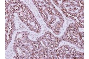 Image no. 1 for anti-3-hydroxyisobutyrate Dehydrogenase (HIBADH) (AA 1-257) antibody (ABIN1501919) (HIBADH antibody  (AA 1-257))