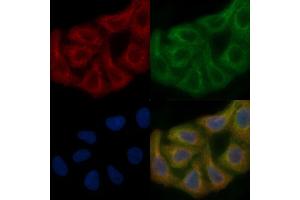 PMPCA Mouse Monoclonal Antibody staining Hela cells by IF/ICC. (PMPCA antibody)