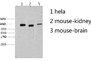 Western blot analysis of 1) Hela, 2) mouse kidney, 3) mouse brain, diluted at 1:2000. (Cytokeratin 7 antibody)
