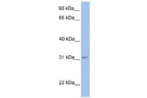 ECHDC2 antibody used at 1 ug/ml to detect target protein. (ECHDC2 antibody  (Middle Region))