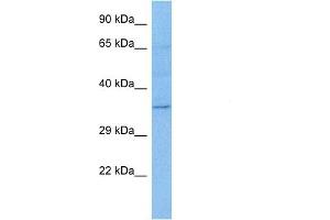 Host:  Rat  Target Name:  DPF1  Sample Tissue:  Rat Skeletal Muscle  Antibody Dilution:  1ug/ml (DPF1 antibody  (Middle Region))