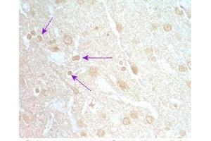 Rat brain tissue was stained by Rabbit Anti-Neuromedin S Prepro (70-103) (Rat) Serum (NMS antibody  (Preproprotein))