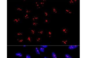 Confocal immunofluorescence analysis of U2OS cells using DDX21 Polyclonal Antibody at dilution of 1:100. (DDX21 antibody)