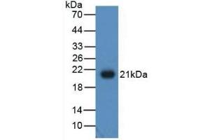 Detection of Recombinant ADP, Human using Polyclonal Antibody to Adiponectin (ADPN) (ADIPOQ antibody  (AA 108-244))