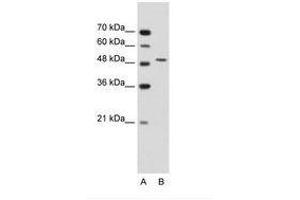 Image no. 3 for anti-Semenogelin I (SEMG1) (AA 51-100) antibody (ABIN203500) (SEMG1 antibody  (AA 51-100))