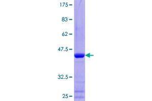 TXNL4B Protein (AA 1-149) (GST tag)