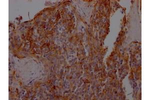 Immunohistochemistry (IHC) image for anti-Intercellular Adhesion Molecule 1 (ICAM1) antibody (ABIN7127559)