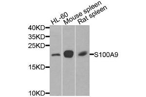 Western blot analysis of extracts of various cell lines, using S100A9 antibody (ABIN6003574) at 1/1000 dilution. (S100A9 antibody)