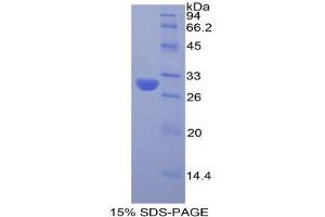 SDS-PAGE (SDS) image for Acrosin (ACR) (AA 43-291) protein (His tag) (ABIN2120443)
