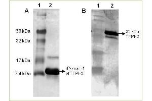 Western Blot analysis of rhuman TFPI-2 using Anti-Human TFPI-2 IgG Human TFPI-2 protein was resolved by SDS-PAGE, transferred to a NC membrane. (TFPI2 antibody)